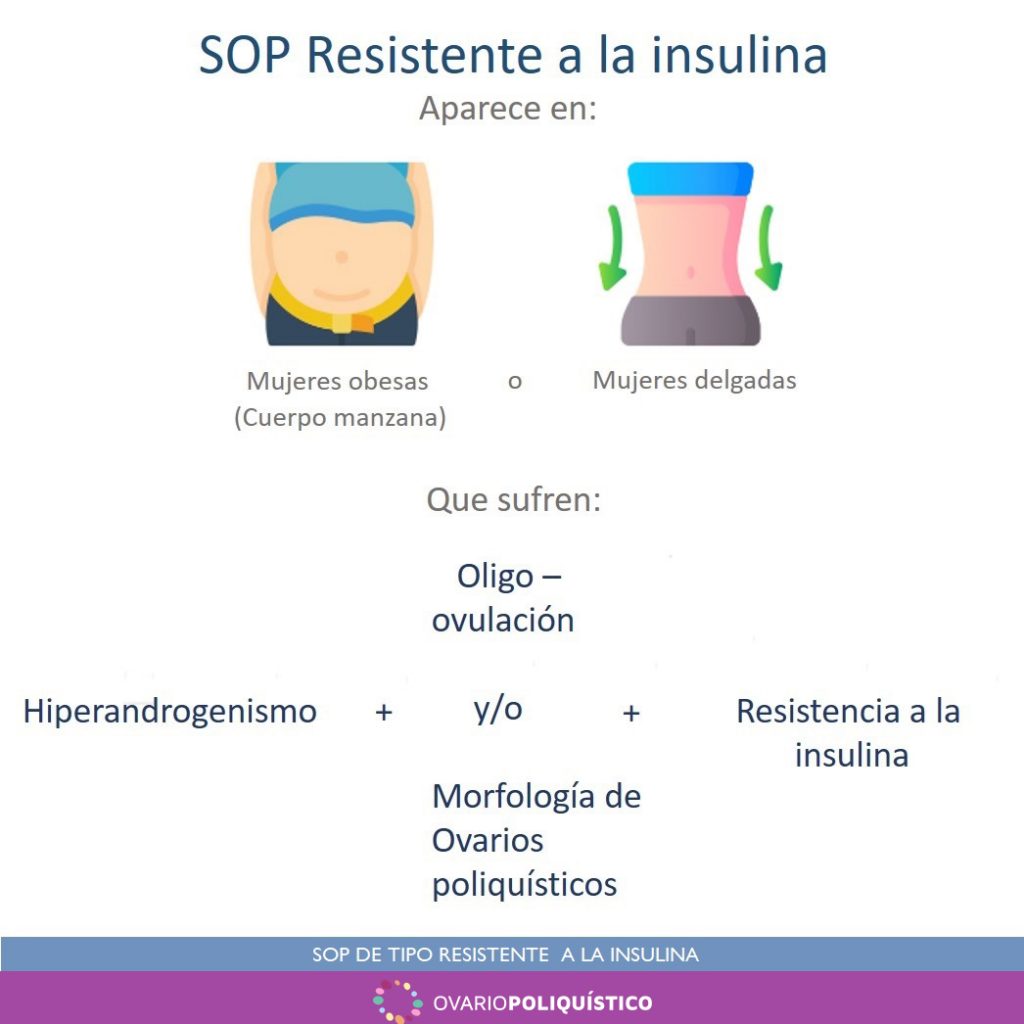 SOP de tipo resistente a la insulina